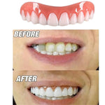 Upper and Lower Teeth Silicone Artificial Teeth Braces